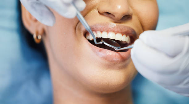 Best Emergency Gum Treatment in Cordele, GA
